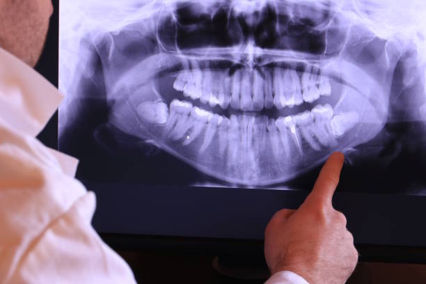 Best Tooth Infection Emergency Dentist  in Dickson, OK