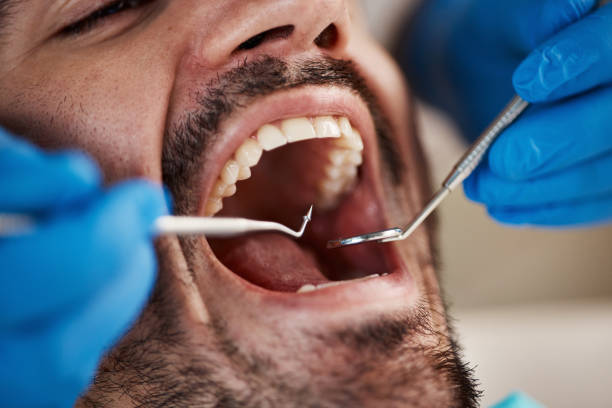 Best Broken Tooth Emergency  in Dickson, OK