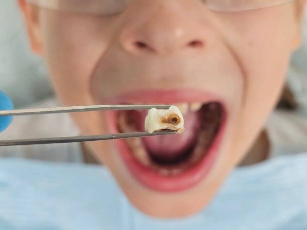 Best Tooth Pain Emergency Relief  in Dickson, OK