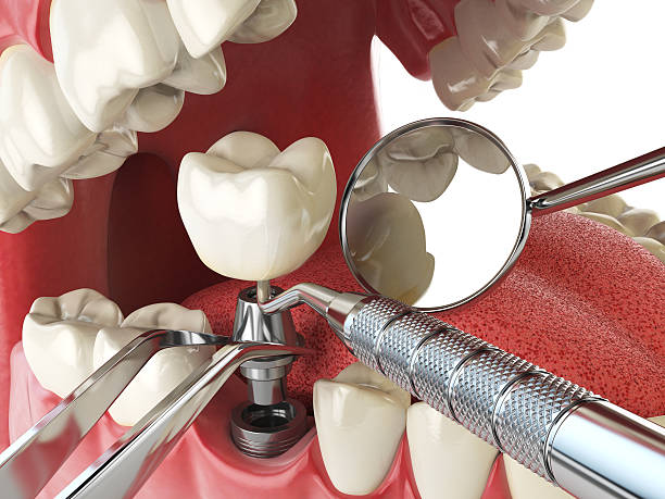 Best Emergency Tooth Extraction  in Dickson, OK