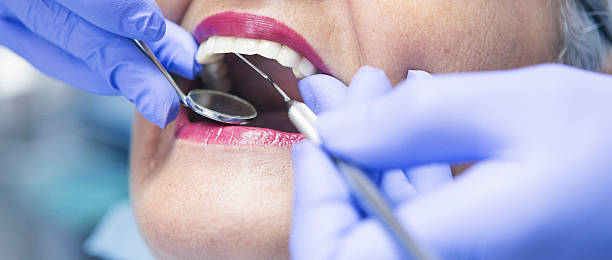 Emergency Dental Filling Replacement in OK